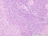 Thumbnail for dataset humanspleen_d2