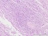 Thumbnail for dataset humanspleen_d3