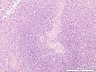 Thumbnail for dataset humanspleen_d5