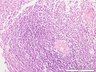 Thumbnail for dataset humanspleen_d8