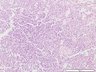Thumbnail for dataset humanspleen_d16