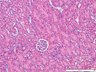 Thumbnail for dataset mousekidney_d0
