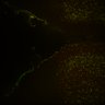 Thumbnail for Fig6_Whole_brain_imaging191_20180329_00407