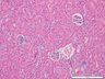 Thumbnail for dataset mousekidney_d2