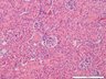 Thumbnail for dataset mousekidney_d5