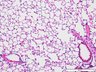 Thumbnail for dataset mouselung_d4