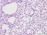 Thumbnail for dataset mouselung_d7