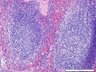 Thumbnail for dataset mousespleen_d0