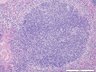 Thumbnail for dataset mousespleen_d2