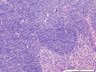 Thumbnail for dataset mousespleen_d5