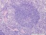 Thumbnail for dataset mousespleen_d16