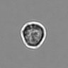 Thumbnail for dataset 3mix-timelapse-plate3_80