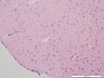 Thumbnail for dataset muosebrain_d5
