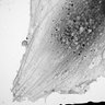 Thumbnail for dataset fig11C_normal_1