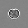 Thumbnail for dataset 3mix-timelapse-plate13_10