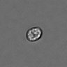 Thumbnail for PBMC-timelapse-plate6_79