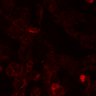 Thumbnail for dataset SuppFig3A_4T1_Gqinhibitor_N3