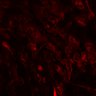 Thumbnail for dataset SuppFig3A_4T1_GqKO_N2