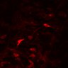 Thumbnail for dataset SuppFig3A_4T1_parental_N2