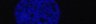 Thumbnail for dataset Fig4B_COS7_Hismet-HP1aCD