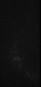 Thumbnail for dataset 1_MovieS1_immotile_cilia