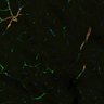 Thumbnail for dataset NG2BChR2_1401_GFPSMAa2_20X_striatum