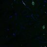 Thumbnail for dataset NG2BChR2_4459_GFPSMAa2_20X_Striatum