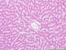 Thumbnail for dataset humanliver_d3