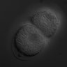 Thumbnail for dataset RNAi_Y49E10.19_070814_02