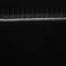 Thumbnail for dataset Fig5_ph(FilTer)50TxRed100YFP100_Bin2_YK0136_15Cp_2_Pos9