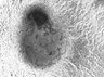 Thumbnail for dataset lacrimal_bioengineered_D5