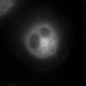 Thumbnail for dataset Fig1e_SuppleMovie1_BV6-zVAD-GSK