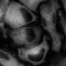 Thumbnail for dataset Fig3b_MLKL-KO_BV6-zVAD