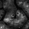 Thumbnail for dataset Fig6b_SuppleMovie6_Kidney-CDDP