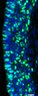 Thumbnail for dataset FigureS12A_Foxg1CreSox9FF_E14.5_Ventral