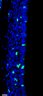 Thumbnail for dataset FigureS12A_Foxg1CreSox9FF_E16.5_Dorsal