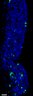 Thumbnail for dataset FigureS12A_Foxg1CreSox9FF_E18.5_Dorsal
