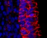 Thumbnail for dataset FigureS15A_E16.5_CTNNB1