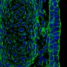Thumbnail for dataset FigureS15B_E16.5_Factin
