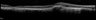 Thumbnail for dataset figS11_1week