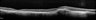 Thumbnail for dataset figS11_3days