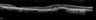 Thumbnail for dataset figS11_4weeks