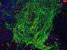 Thumbnail for dataset Fig2D_hypoxia