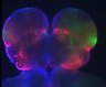 Thumbnail for dataset Brain_48