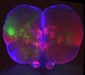 Thumbnail for dataset Brain_62