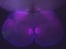 Thumbnail for dataset Brain_75