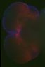Thumbnail for dataset Brain_82_left