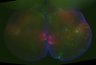 Thumbnail for dataset Brain_83_right