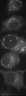 Thumbnail for dataset Fig5_1h_Lipid