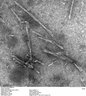 Thumbnail for dataset Fig2b_TEM_MSA2